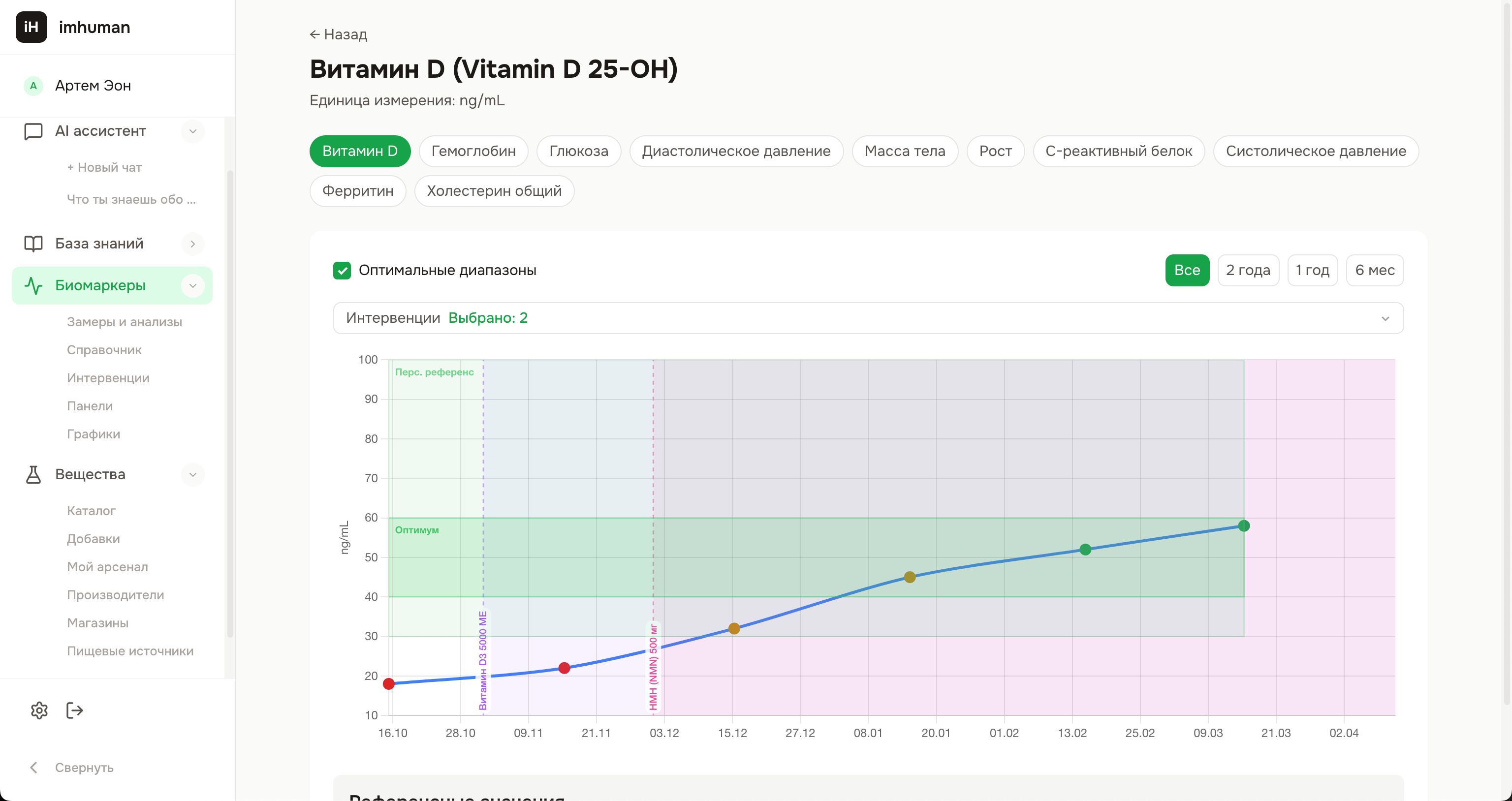 Графики с интервенциями